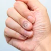Kenapa Ya Kuku Bisa Terus Menerus Tumbuh? Dan Apa Fungsinya dari Kuku? Ternyata sudah Ada Ribuan tahun sebelum Nenek Moyang