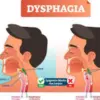 Pengertian dan Gejala Disfagia