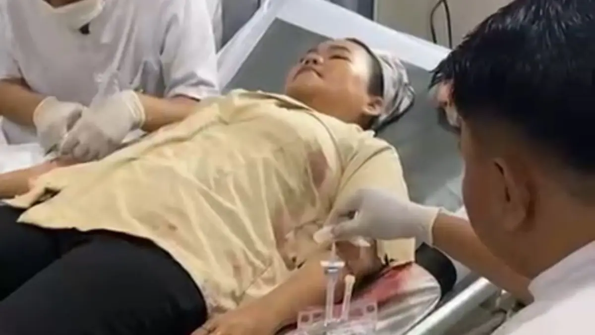 Guru SD Jadi Korban Begal di Jalan Kodam Wanajaya Cibitung, Motor Dirampas, Alami Tiga Luka Robek Begal