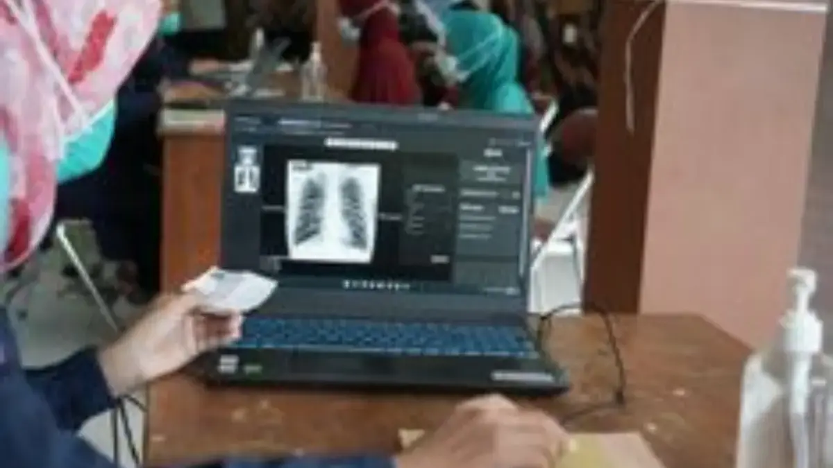 DARURAT, Trend Kasus TBC di Karawang Bisa Tembus 13 Ribu, Dinkes Kewalahan SDM dan Faskes Ist