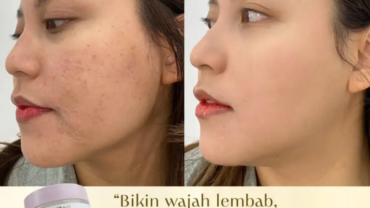 Kulit Rewel Merah Gatal? B ERL Madecera Barrier Moisturizer Bikin Kuat Lembap 24 Jam – Skin Barrier Savior! B ERL Madecera Barrier Moisturizer