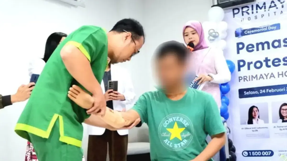 Inovasi Tangan Protesis Fungsional untuk Pemulihan Pasien Kecelakaan Kerja di Primaya Hospital Karawang Primaya Hospital Karawang menghadirkan inovasi pemasangan tangan protesis