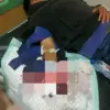 Tangan remaja nyaris putus gegara tawuran